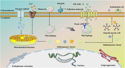 Research progress on the natural products in the intervention of myocardial infarction